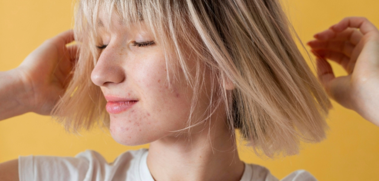 Jakie zmiany skórne mogą świadczyć o chorobie i potrzebie konsultacji dermatologic